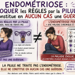 Endométriose